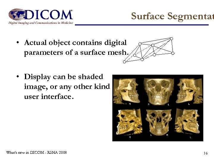 Surface Segmentat • Actual object contains digital parameters of a surface mesh. • Display