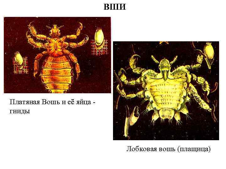 ВШИ Платяная Вошь и её яйца гниды Лобковая вошь (плащица) 