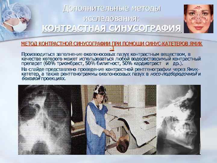 Дополнительные методы исследования: КОНТРАСТНАЯ СИНУСОГРАФИЯ МЕТОД КОНТРАСТНОЙ СИНУСОГРАФИИ ПРИ ПОМОЩИ СИНУС-КАТЕТЕРОВ ЯМИК -3 Производиться