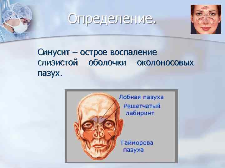 Определение. Синусит – острое воспаление слизистой оболочки околоносовых пазух. 