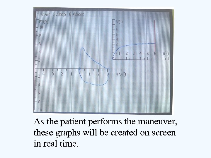 As the patient performs the maneuver, these graphs will be created on screen in