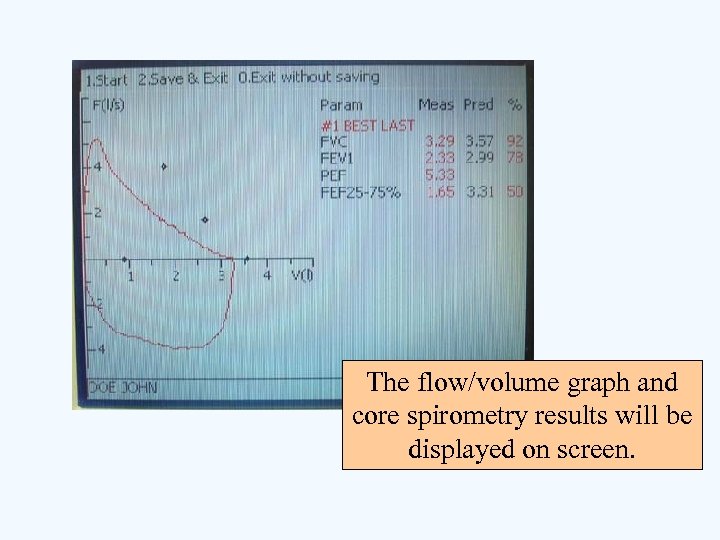 The flow/volume graph and core spirometry results will be displayed on screen. 