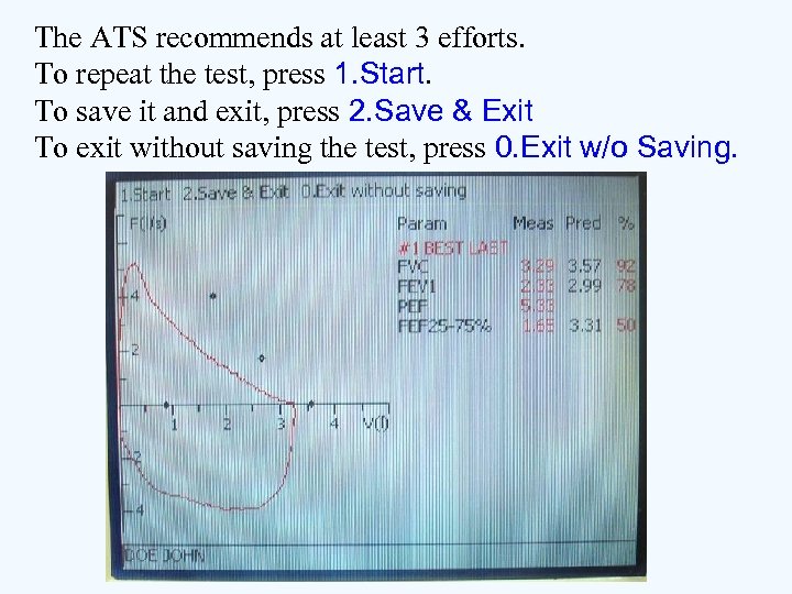 The ATS recommends at least 3 efforts. To repeat the test, press 1. Start.