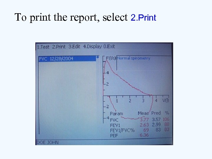 To print the report, select 2. Print 