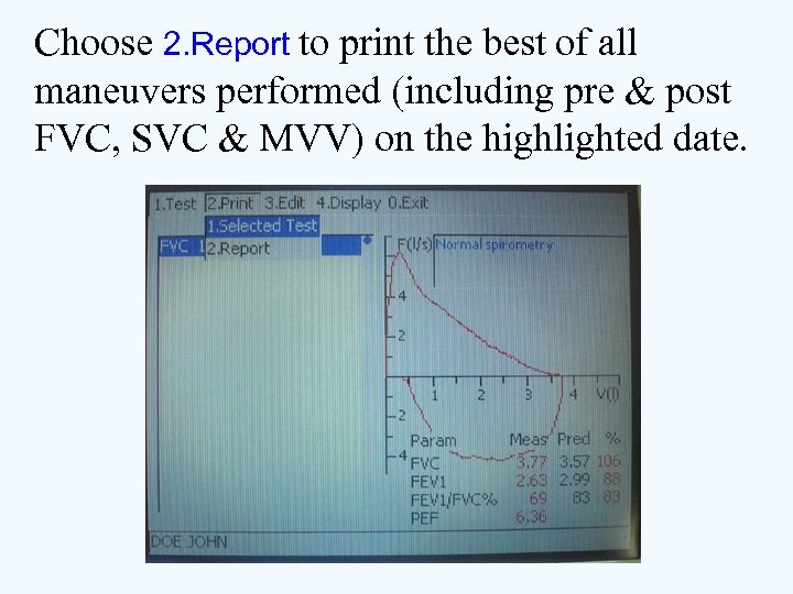 Choose 2. Report to print the best of all maneuvers performed (including pre &