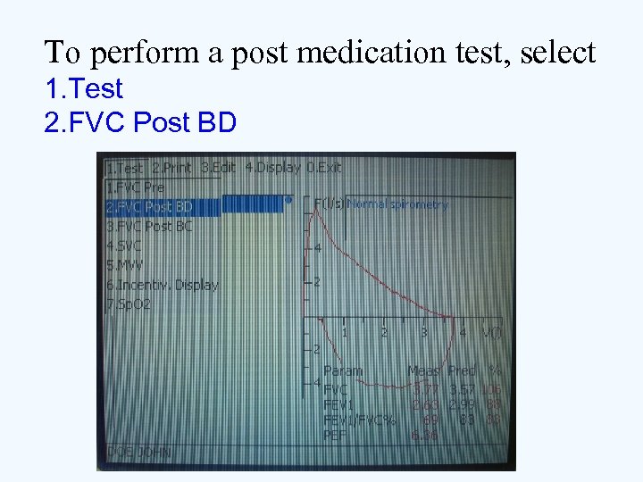 To perform a post medication test, select 1. Test 2. FVC Post BD 