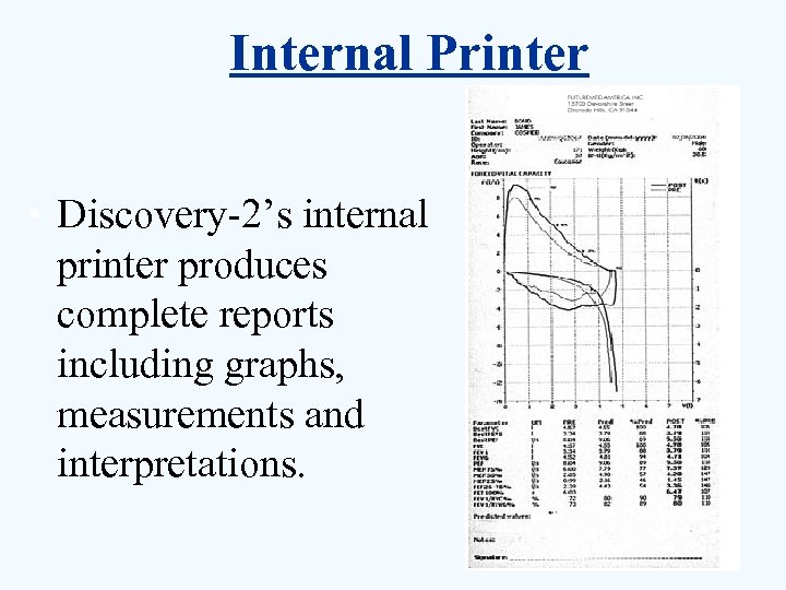 Internal Printer • Discovery-2’s internal printer produces complete reports including graphs, measurements and interpretations.