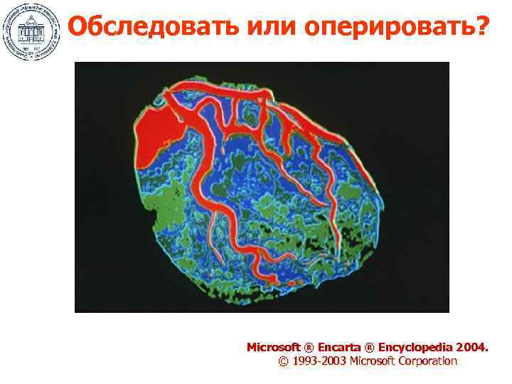 Обследовать или оперировать? Microsoft ® Encarta ® Encyclopedia 2004. © 1993 -2003 Microsoft Corporation