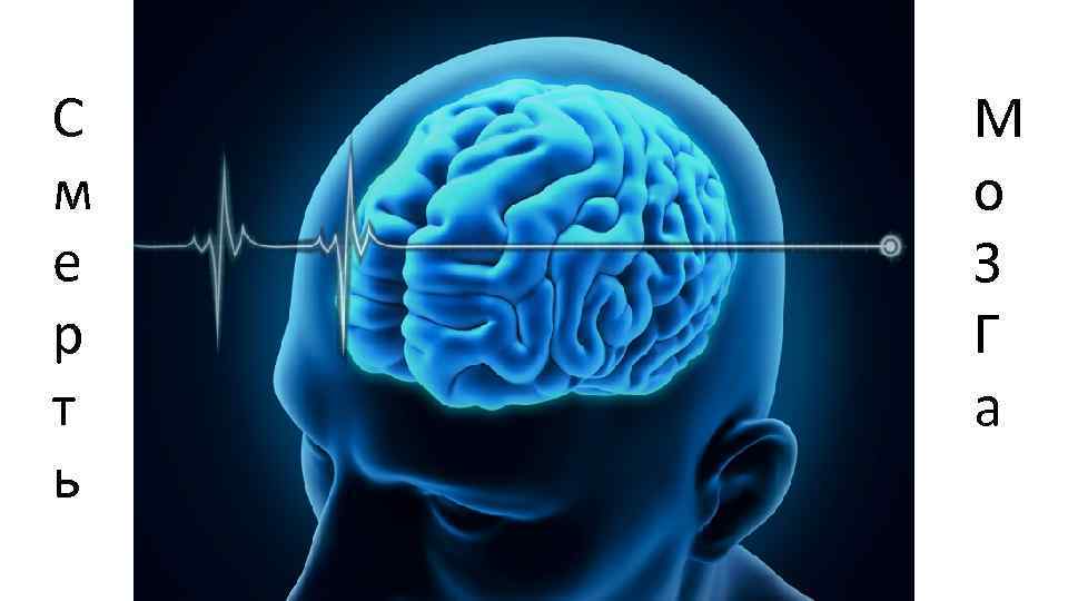 С м е р т ь Смерть мозга М о З Г а 