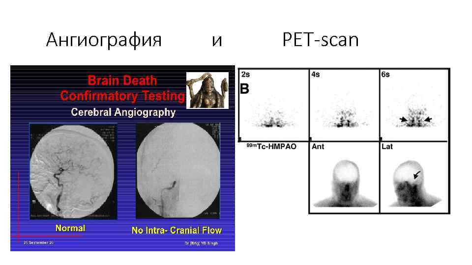 Ангиография и PET-scan 