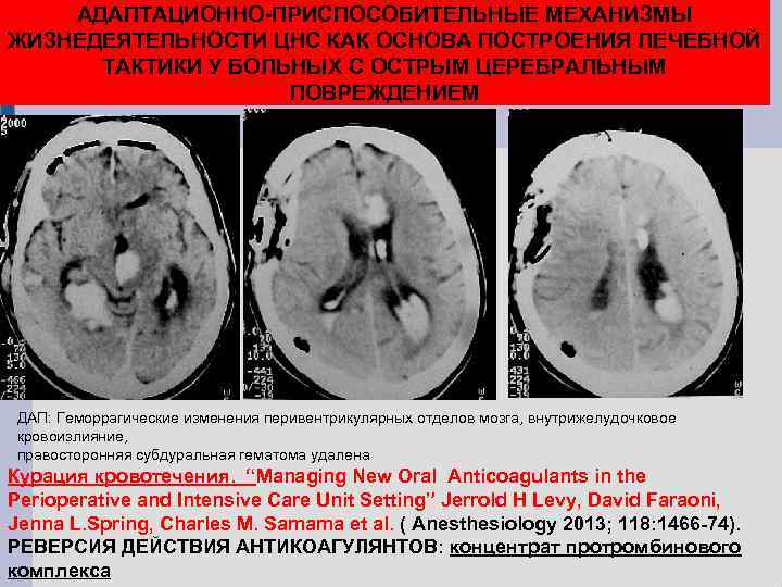 АДАПТАЦИОННО-ПРИСПОСОБИТЕЛЬНЫЕ МЕХАНИЗМЫ ЖИЗНЕДЕЯТЕЛЬНОСТИ ЦНС КАК ОСНОВА ПОСТРОЕНИЯ ЛЕЧЕБНОЙ ТАКТИКИ У БОЛЬНЫХ С ОСТРЫМ ЦЕРЕБРАЛЬНЫМ