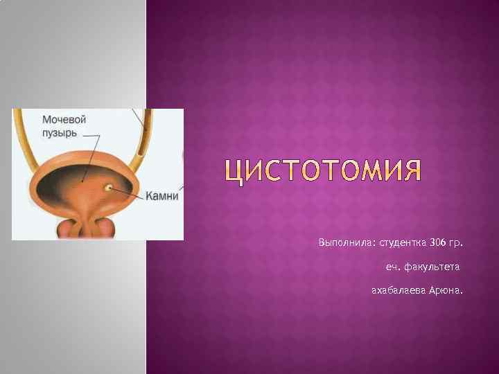 Выполнила: студентка 306 гр. еч. факультета ахабалаева Арюна. 