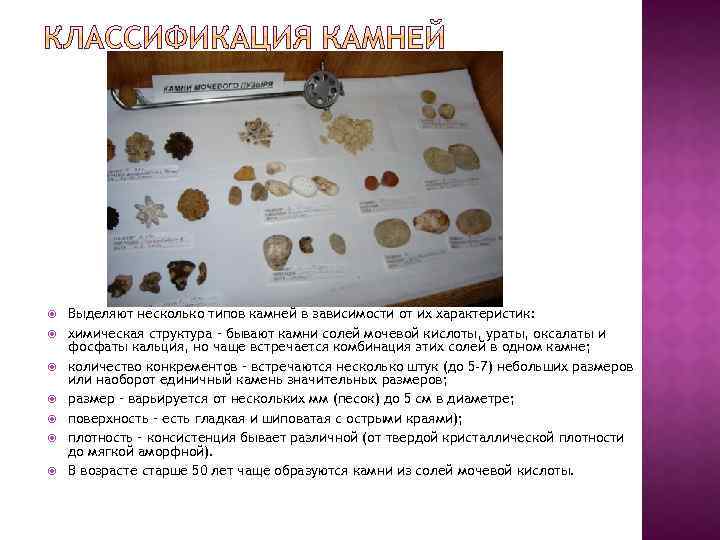  Выделяют несколько типов камней в зависимости от их характеристик: химическая структура – бывают