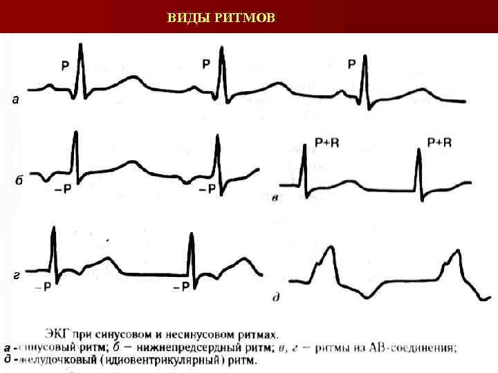 ВИДЫ РИТМОВ 