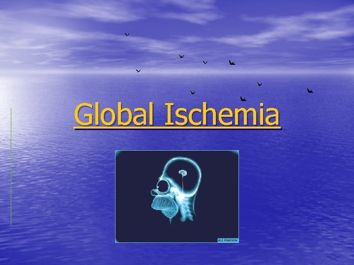 Global Ischemia 