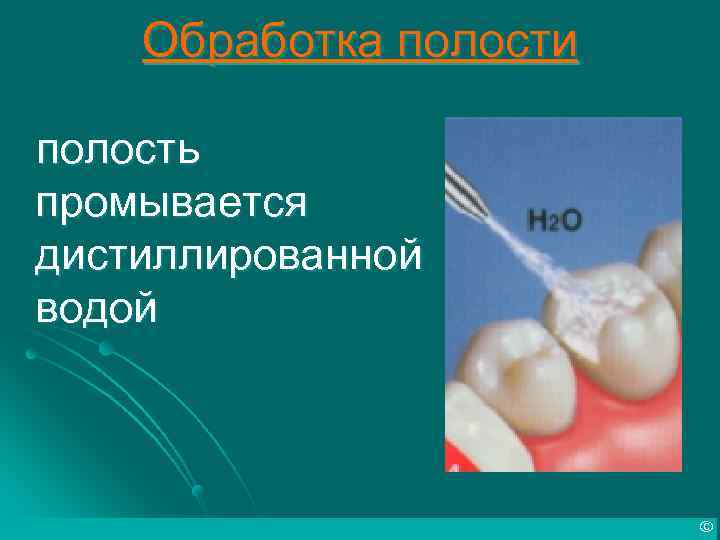 Обработка полости полость промывается дистиллированной водой © 