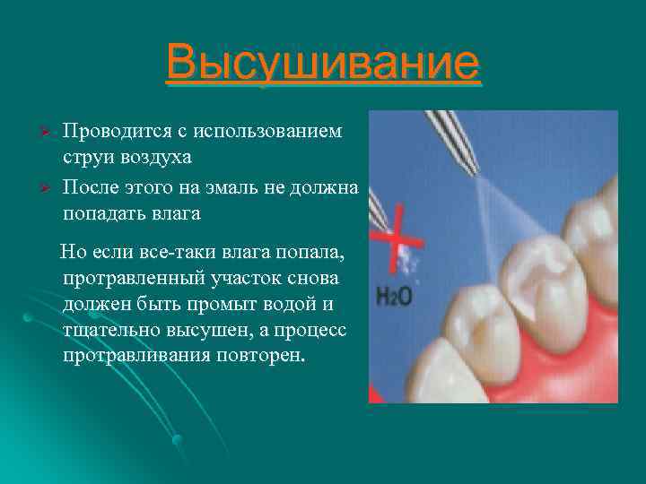 Высушивание Ø Ø Проводится с использованием струи воздуха После этого на эмаль не должна