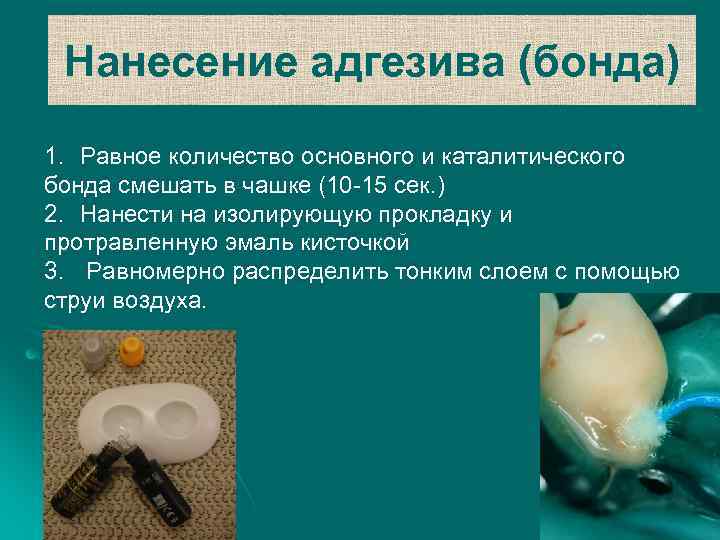 Нанесение адгезива (бонда) 1. Равное количество основного и каталитического бонда смешать в чашке (10