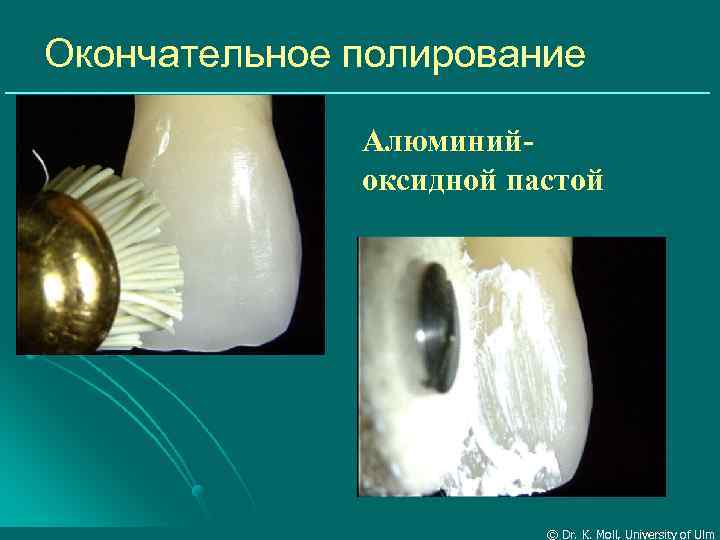 Окончательное полирование Алюминийоксидной пастой © Dr. K. Moll, University of Ulm 