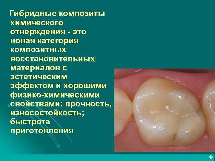 Гибридные композиты химического отверждения - это новая категория композитных восстановительных материалов с эстетическим эффектом