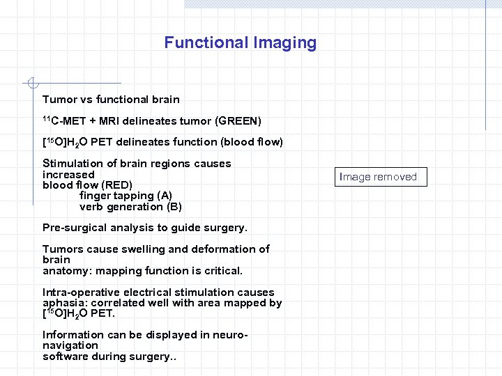 Functional Imaging Tumor vs functional brain 11 C-MET + MRI delineates tumor (GREEN) [15