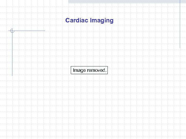 Cardiac Imaging Image removed. 