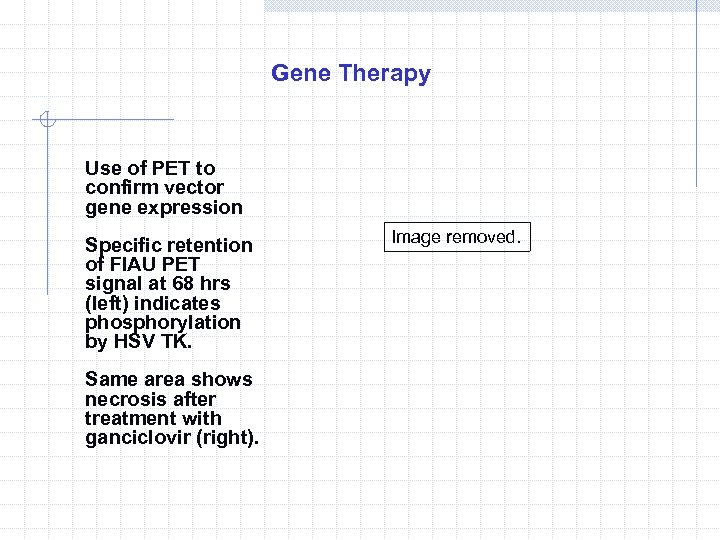 Gene Therapy Use of PET to confirm vector gene expression Specific retention of FIAU