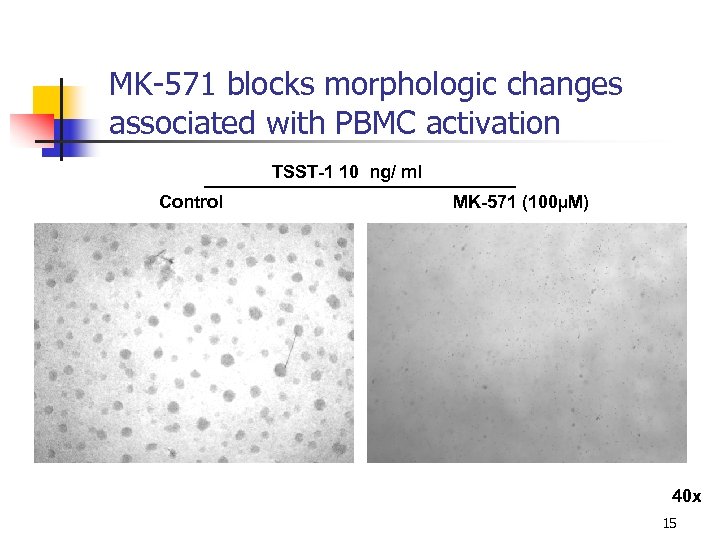 MK-571 blocks morphologic changes associated with PBMC activation TSST-1 10 ng/ ml Control MK-571