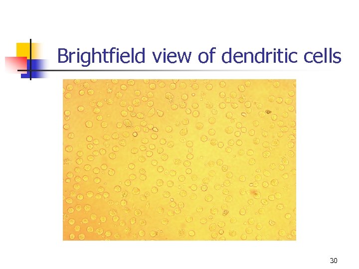 Brightfield view of dendritic cells 30 