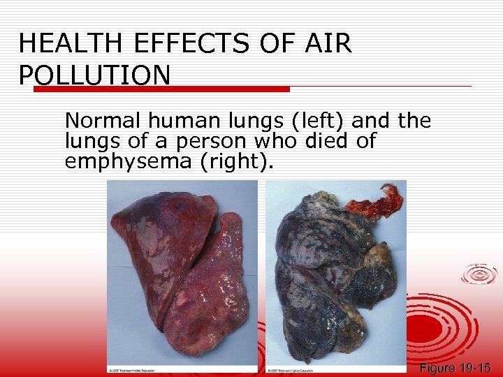 HEALTH EFFECTS OF AIR POLLUTION Normal human lungs (left) and the lungs of a