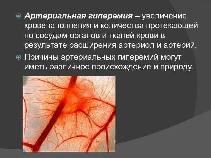Артериальная гиперемия – увеличение кровенаполнения и количества протекающей по сосудам органов и тканей крови