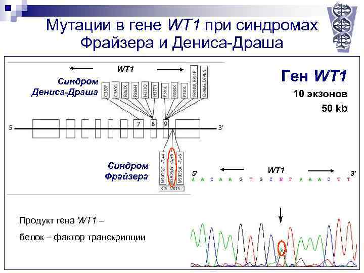 Мутации в гене WT 1 при синдромах Фрайзера и Дениса-Драша WT 1 Ген WT