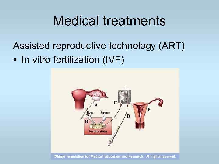 Medical treatments Assisted reproductive technology (ART) • In vitro fertilization (IVF) 