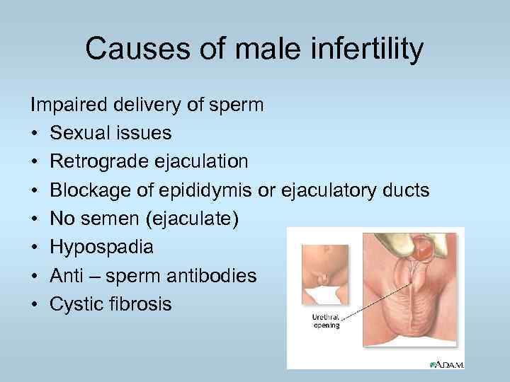 Causes of male infertility Impaired delivery of sperm • Sexual issues • Retrograde ejaculation