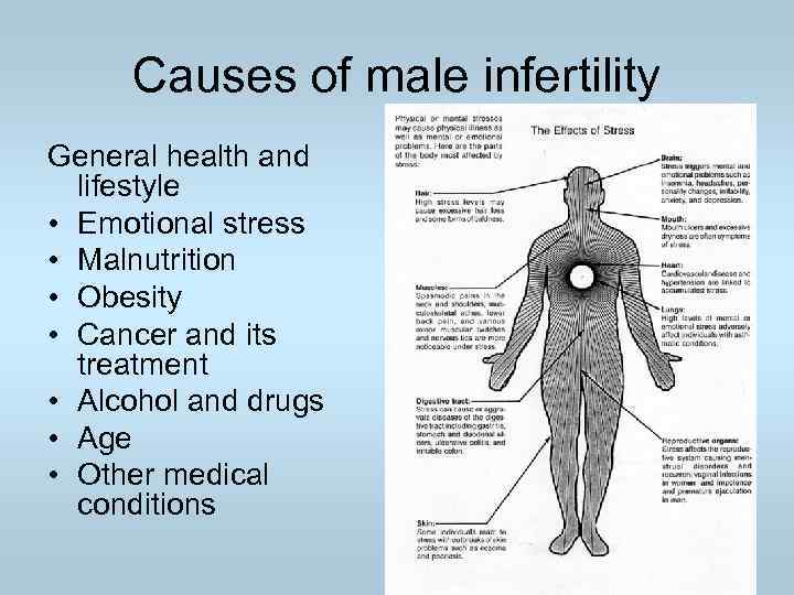 Causes of male infertility General health and lifestyle • Emotional stress • Malnutrition •