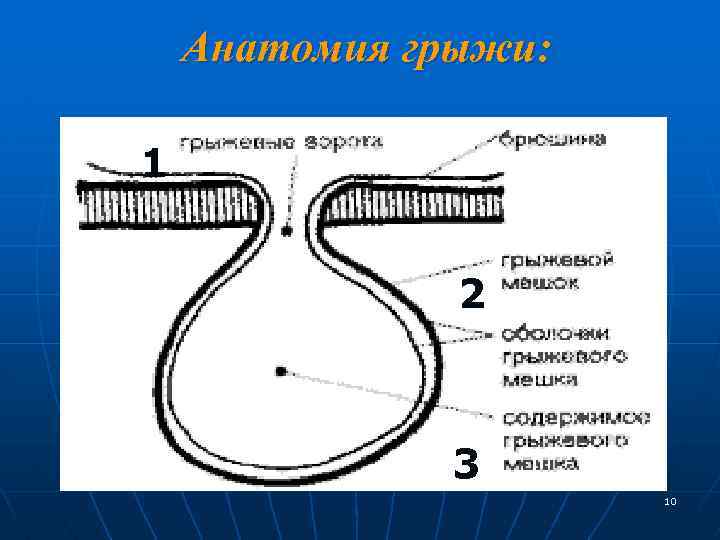 Анатомия грыжи: 1 2 3 10 