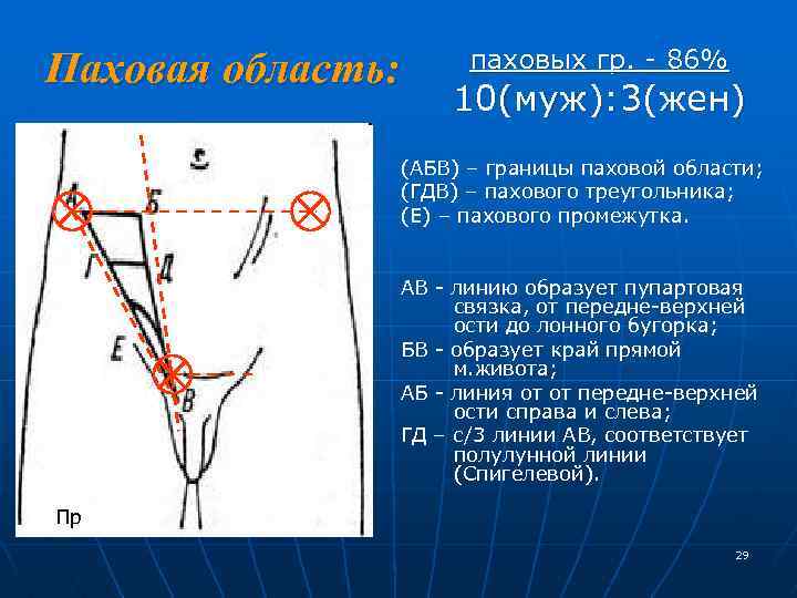 Паховая область: паховых гр. - 86% 10(муж): 3(жен) (АБВ) – границы паховой области; (ГДВ)