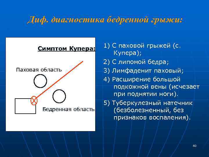 Диф. диагностика бедренной грыжи: Симптом Купера: Паховая область Бедренная область 1) С паховой грыжей