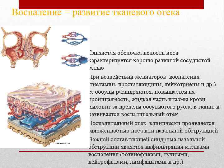 Воспаление = развитие тканевого отека • Слизистая оболочка полости носа характеризуется хорошо развитой сосудистой