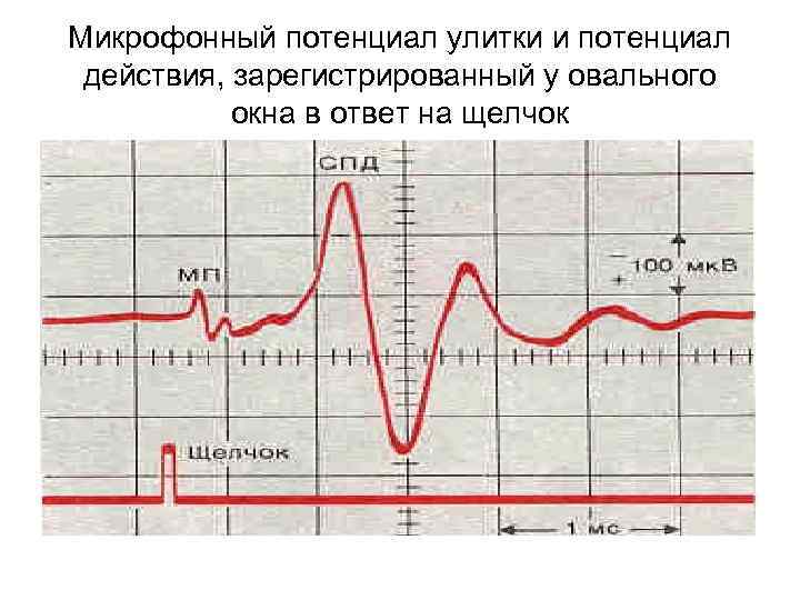 Микрофонный потенциал улитки и потенциал действия, зарегистрированный у овального окна в ответ на щелчок