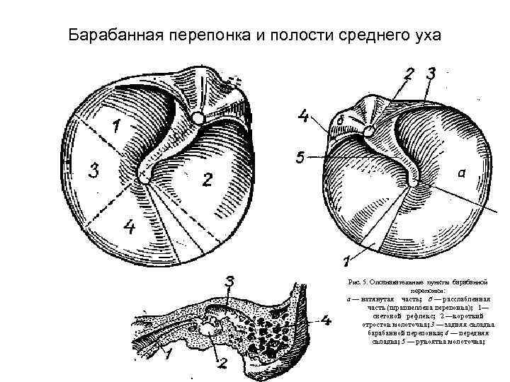 Барабанная перепонка и полости среднего уха Рис. 5. Опознавательные пункты барабанной перепонки: а —