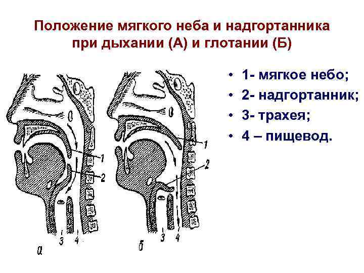 Положение мягкого неба и надгортанника при дыхании (А) и глотании (Б) • • 1