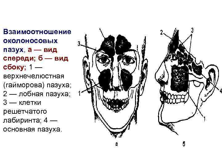 Взаимоотношение околоносовых пазух, а — вид спереди; б — вид сбоку; 1 — верхнечелюстная