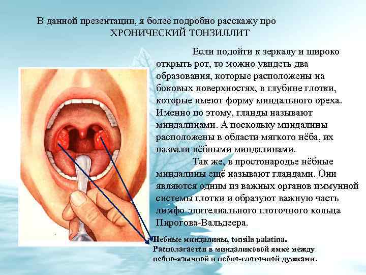 В данной презентации, я более подробно расскажу про ХРОНИЧЕСКИЙ ТОНЗИЛЛИТ Если подойти к зеркалу