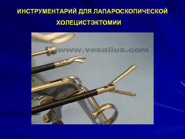 ИНСТРУМЕНТАРИЙ ДЛЯ ЛАПАРОСКОПИЧЕСКОЙ ХОЛЕЦИСТЭКТОМИИ 