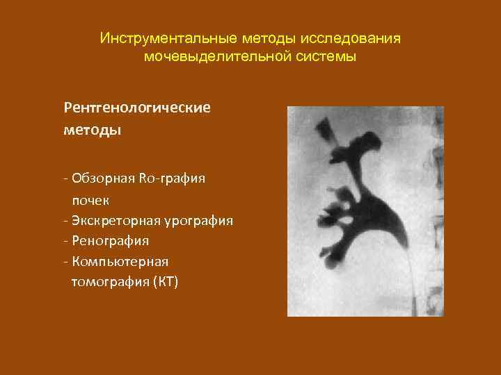 Инструментальные методы исследования мочевыделительной системы Рентгенологические методы - Обзорная Ro-графия почек - Экскреторная урография