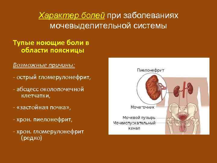 Заболевания мочевыделительной системы презентация