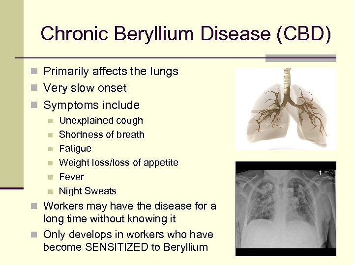 Chronic Beryllium Disease (CBD) n Primarily affects the lungs n Very slow onset n