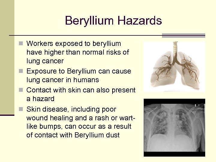 Beryllium Hazards n Workers exposed to beryllium have higher than normal risks of lung