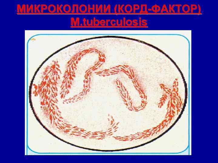 МИКРОКОЛОНИИ (КОРД-ФАКТОР) M. tuberculosis 